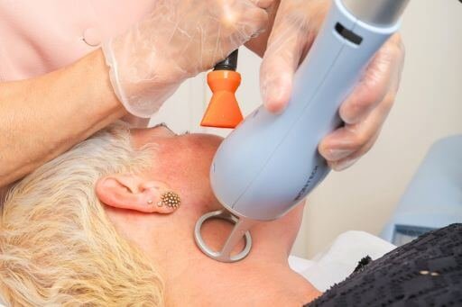 O Laser Lavieen é uma tecnologia dermatológica de ponta que redefine os cuidados com a pele, com tratamentos eficazes para uma ampla gama de condições.